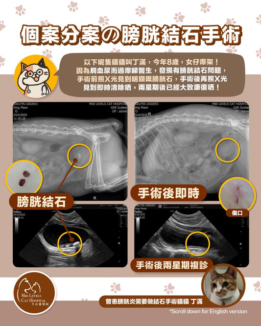 A real-life case of bladder stones
